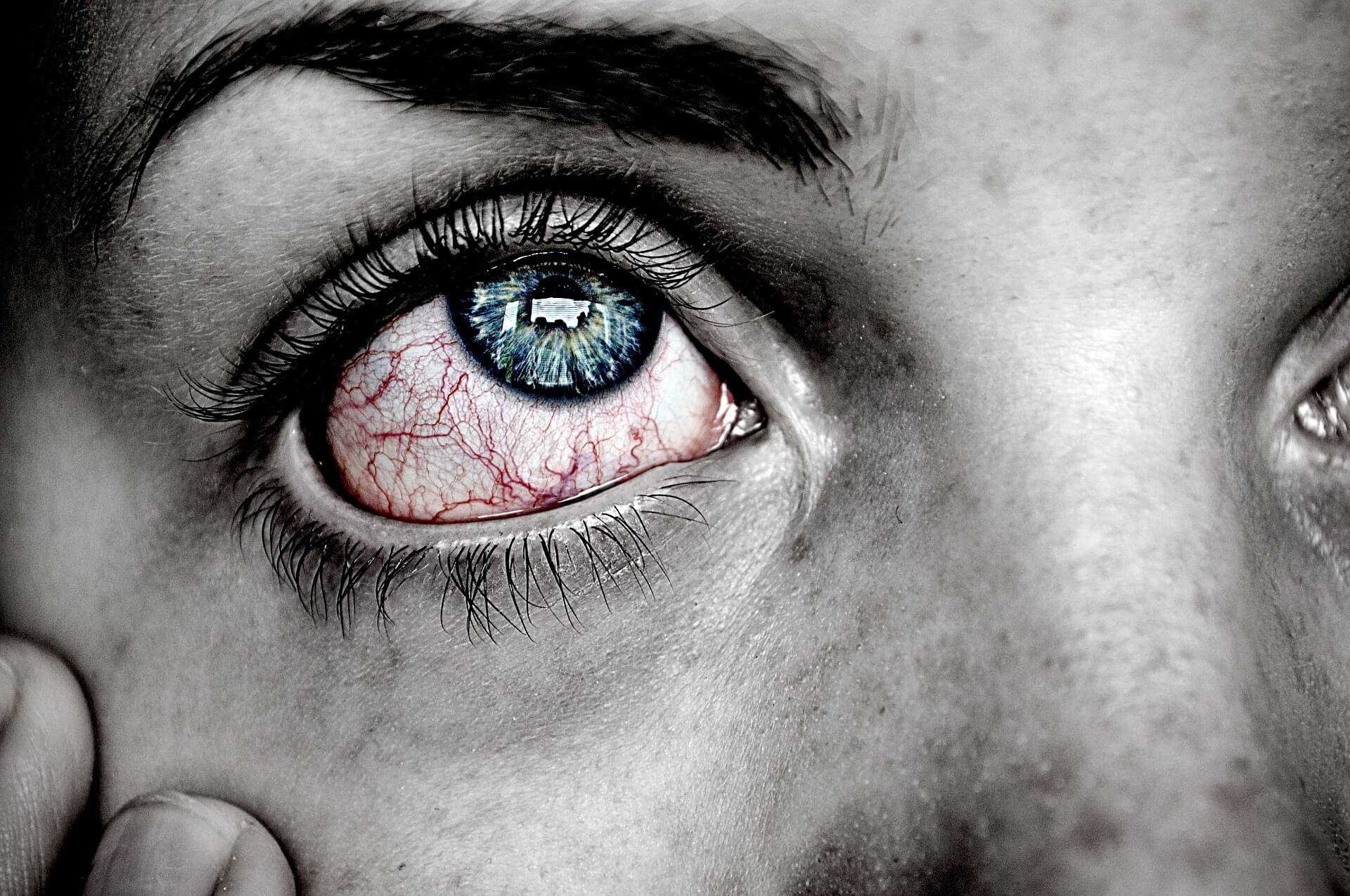 Sânge în ochi – Simptome, cauze, tratament » - Infosan.ro