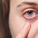 Herpes ocular – ce trebuie să știi pentru a recunoaște mai ușor această afecțiune
