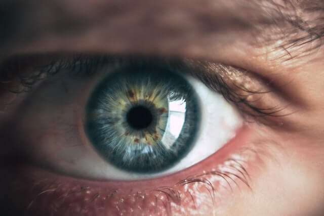 mioza, ochi, iris, retina