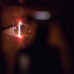 Iridociclita – una dintre cele mai frecvente afecțiuni oculare ce provoacă orbirea. Cauze, simptome, soluții de prevenire și de tratament