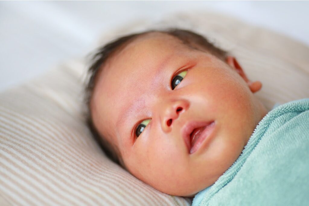 ochi bebe, bebelus, ochi galbeni, icter, icter bebe