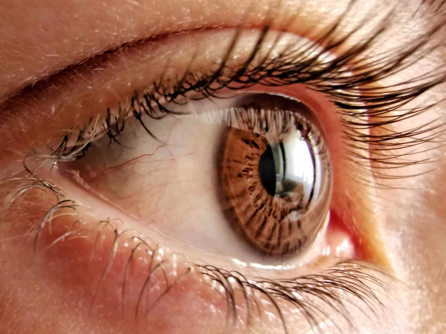 ochi, ochi caprui, gene