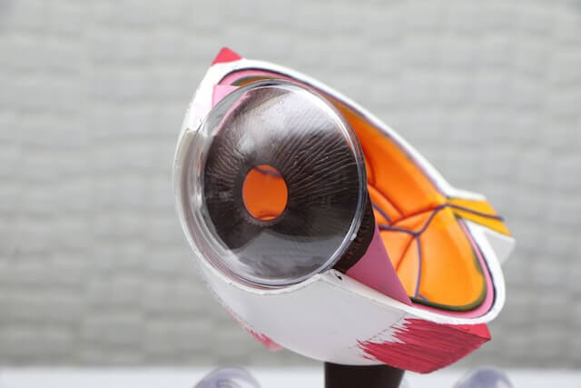 ochi uman, nerv optic, vederen neclara