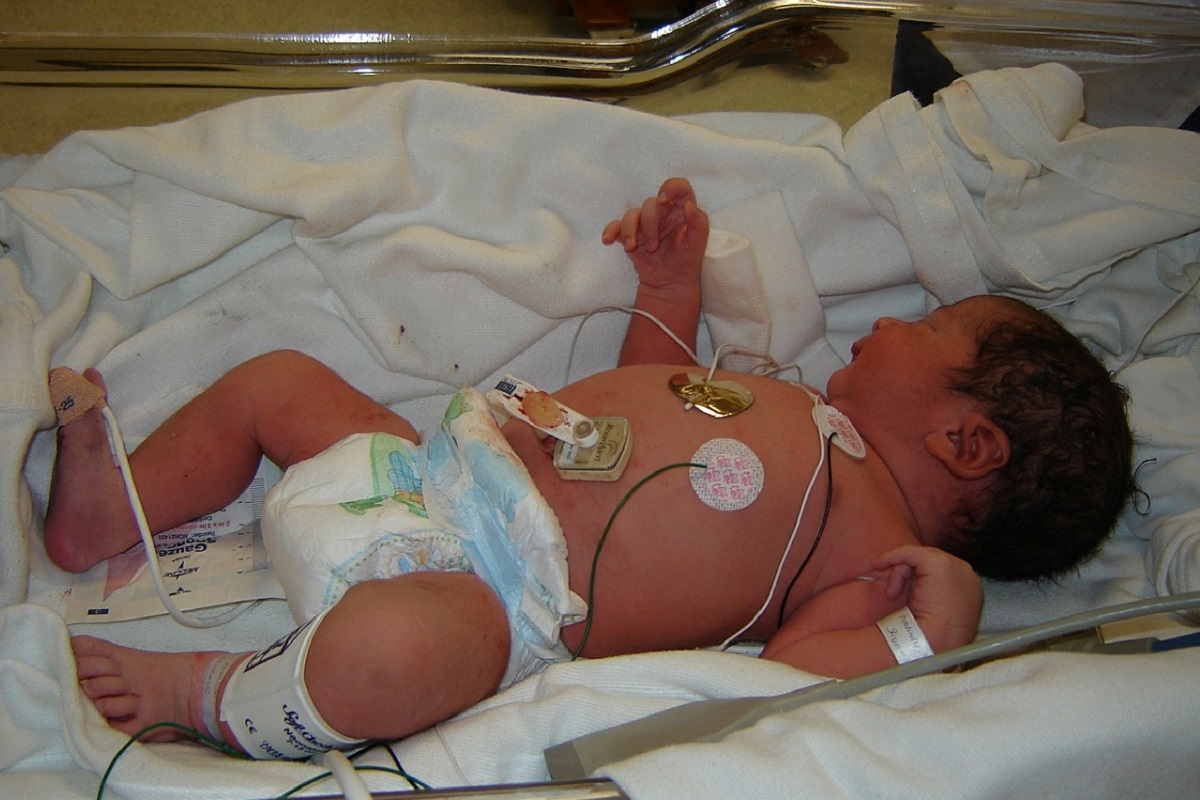 Malformatii congenitale