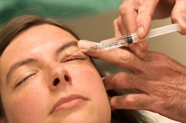 Şalazion închistat - cum se poate diagnostica şi trata şalazionul - interventie chirugicala, pacientă cu chalazion