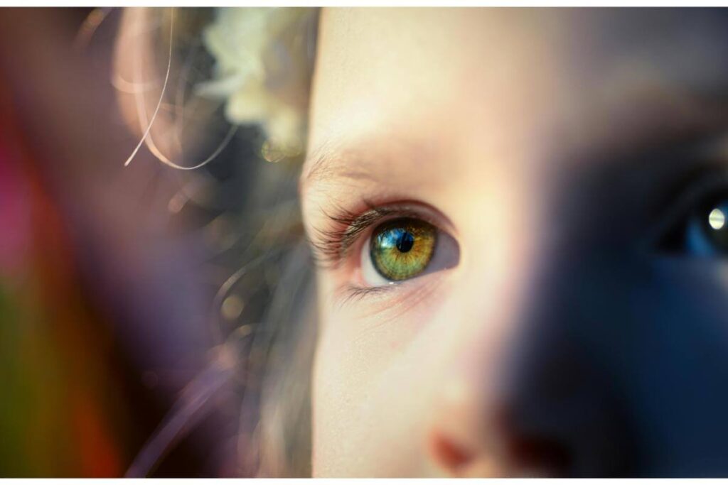 Subluxatie de cristalin-fata ochi verzi