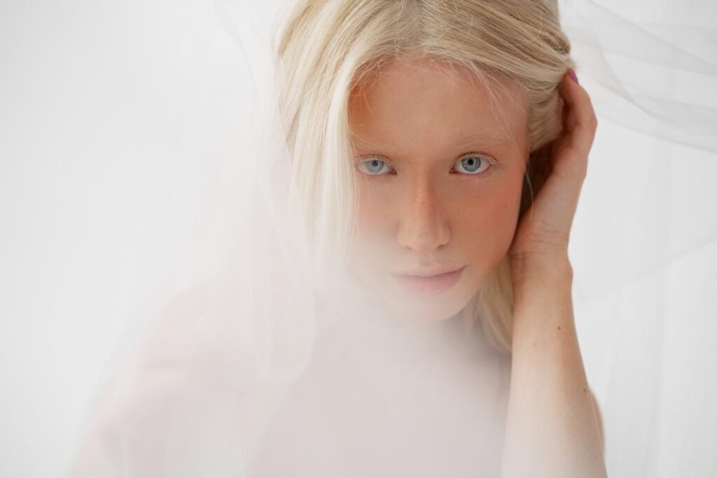 Albinismul la om_metode de gestionare + curiozități despre albinism_fata, par blond, mana