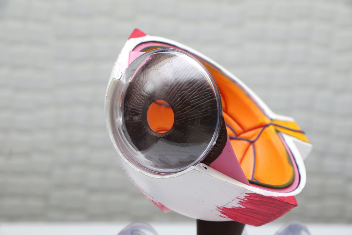 Esotropie tipuri diferentieri tratamente